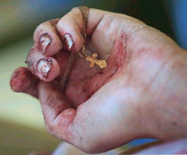 Wounded Beslan Child with Cross
